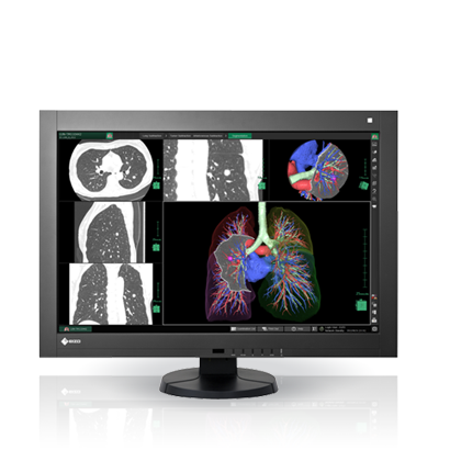 EIZO MEDICAL DISPLAY RadiForce PACS Color LCD 4M Solution (RX440)