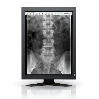 EIZO MEDICAL DISPLAY RadiForce PACS Grayscale LCD 2M Solution (GS220)