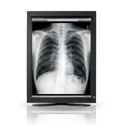 EIZO MEDICAL DISPLAY RadiForce PACS Grayscale LCD 3M Solution (GS320)