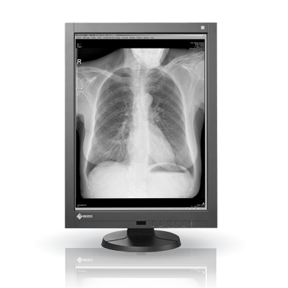 EIZO MEDICAL DISPLAY RadiForce PACS Grayscale LCD 3M Solution (GX340)