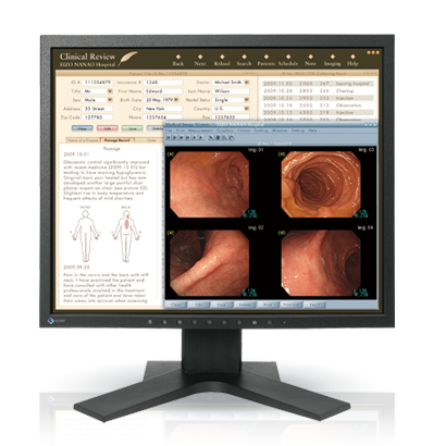 EIZO MEDICAL DISPLAY RadiForce Series 19" MX-Series (MX191)	