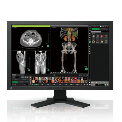 EIZO MEDICAL DISPLAY RadiForce Series 24.1" MX-Series (MX241W)	