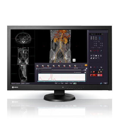 EIZO MEDICAL DISPLAY RadiForce Series 27" MX-Series (MX270W)	