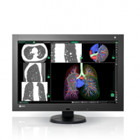 EIZO MEDICAL DISPLAY RadiForce PACS Color LCD 4M Solution (RX440)