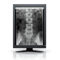 EIZO MEDICAL DISPLAY RadiForce PACS Grayscale LCD 2M Solution (GS220)