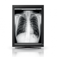 EIZO MEDICAL DISPLAY RadiForce PACS Grayscale LCD 3M Solution (GS320)