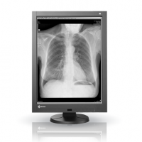 EIZO MEDICAL DISPLAY RadiForce PACS Grayscale LCD 3M Solution (GX340)