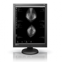 EIZO MEDICAL DISPLAY RadiForce PACS Grayscale LCD 5M Solution (GX540)