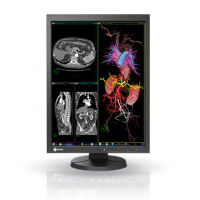 EIZO MEDICAL DISPLAY RadiForce Series 21.3" MX-Series (MX215)	