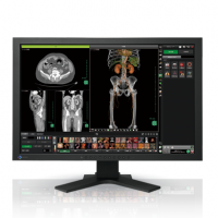 EIZO MEDICAL DISPLAY RadiForce Series 24.1" MX-Series (MX241W)	
