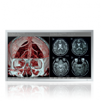 EIZO MEDICAL DISPLAY RadiForce Series Surgical Monitors (LX470W)